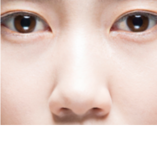 수술 전