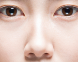 수술 후